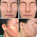 Creme Hidratante Facial Anti Rugas Cuidados Pessoais Anti Idade