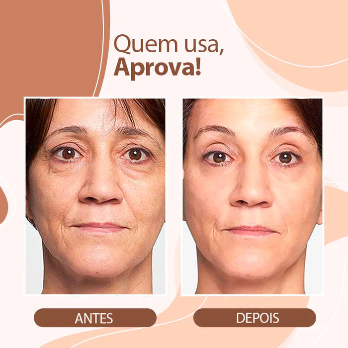 Bálsamo Derol - Tratamento Para Rugas - Ultimo Dia de Promoção