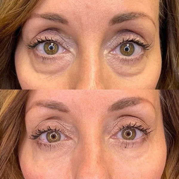 Hidratante Multi Balm antirrugas, olheiras e linhas de expressão Derol Silky